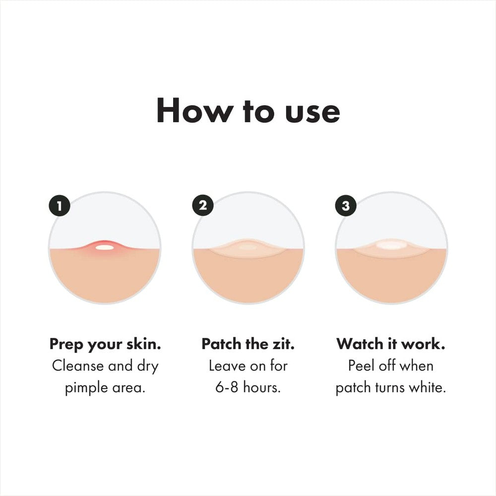 5-Pack Mighty Patch - Hydrocolloid Acne Pimple Patch for Covering Zits and Blemishes, Spot Stickers for Face and Skin (180Ct Total)