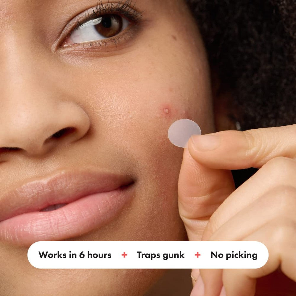 5-Pack Mighty Patch - Hydrocolloid Acne Pimple Patch for Covering Zits and Blemishes, Spot Stickers for Face and Skin (180Ct Total)