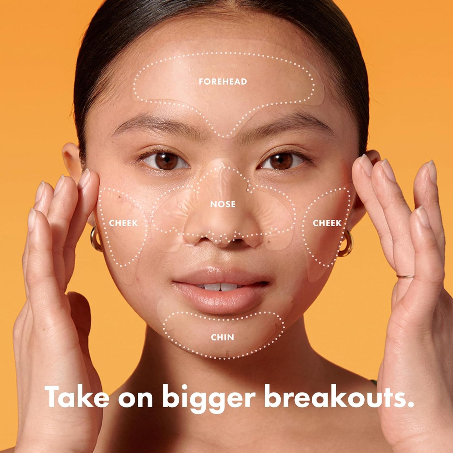 Mighty Patch Hero Cosmetics Face Patch - XL Hydrocolloid Face Mask for Acne, 5 Large Pimple Patches for Zit Breakouts on Nose, Chin, Forehead & Cheeks